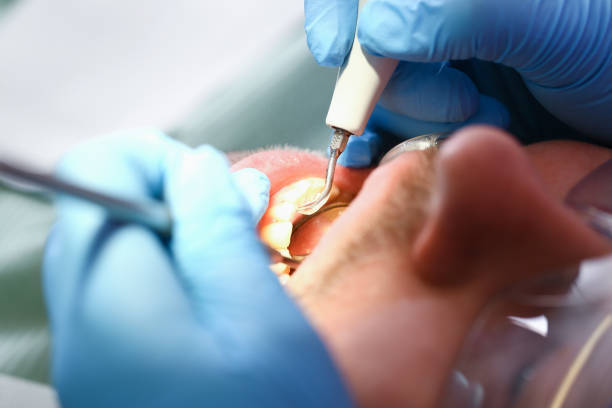 Best Emergency Dental Surgery in Watauga, TX