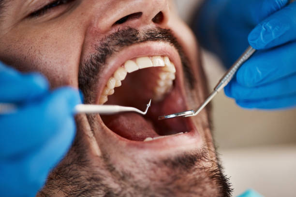 Best Emergency Dental Care for Trauma or Injury in Watauga, TX